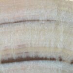 Onyx Arco Vein Cut